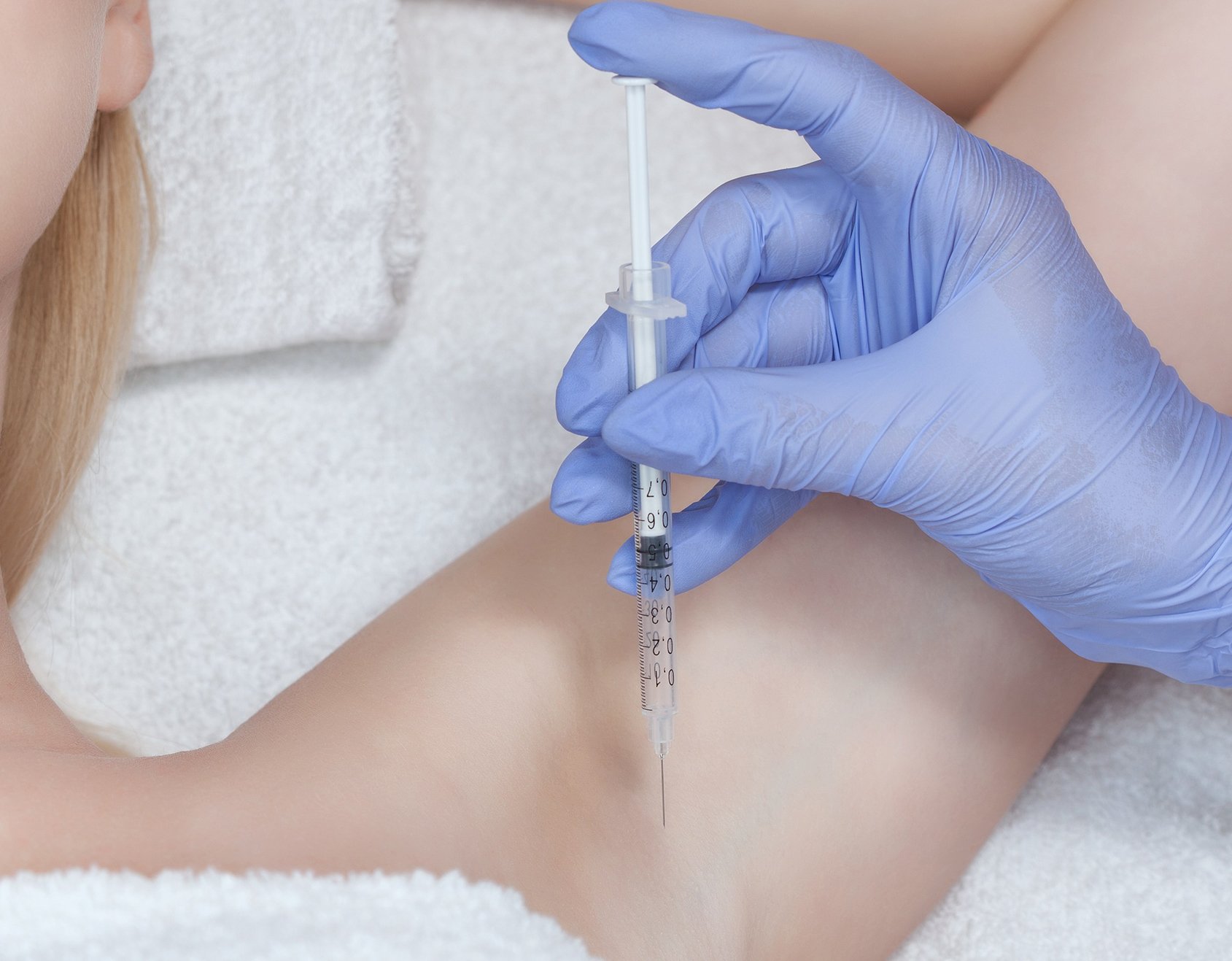 Hyperhidrosis Treatment Windsor | Anti-Sweat Injections | Bare Brilliance